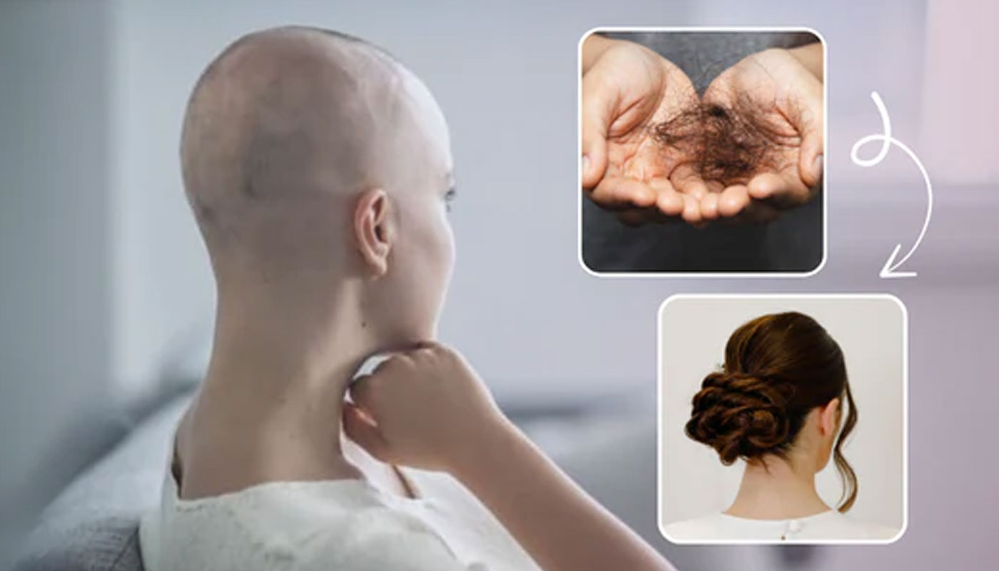 Featured image for “Hair Growth After Chemo and Beyond: How HairSmart Is Redefining Regenerative Haircare”